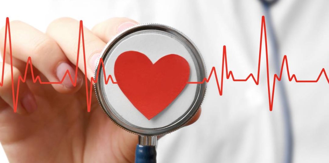 ECG Interpretation